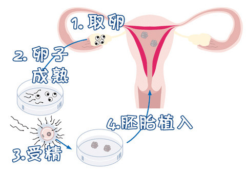 关于供卵包男孩正规代生公司